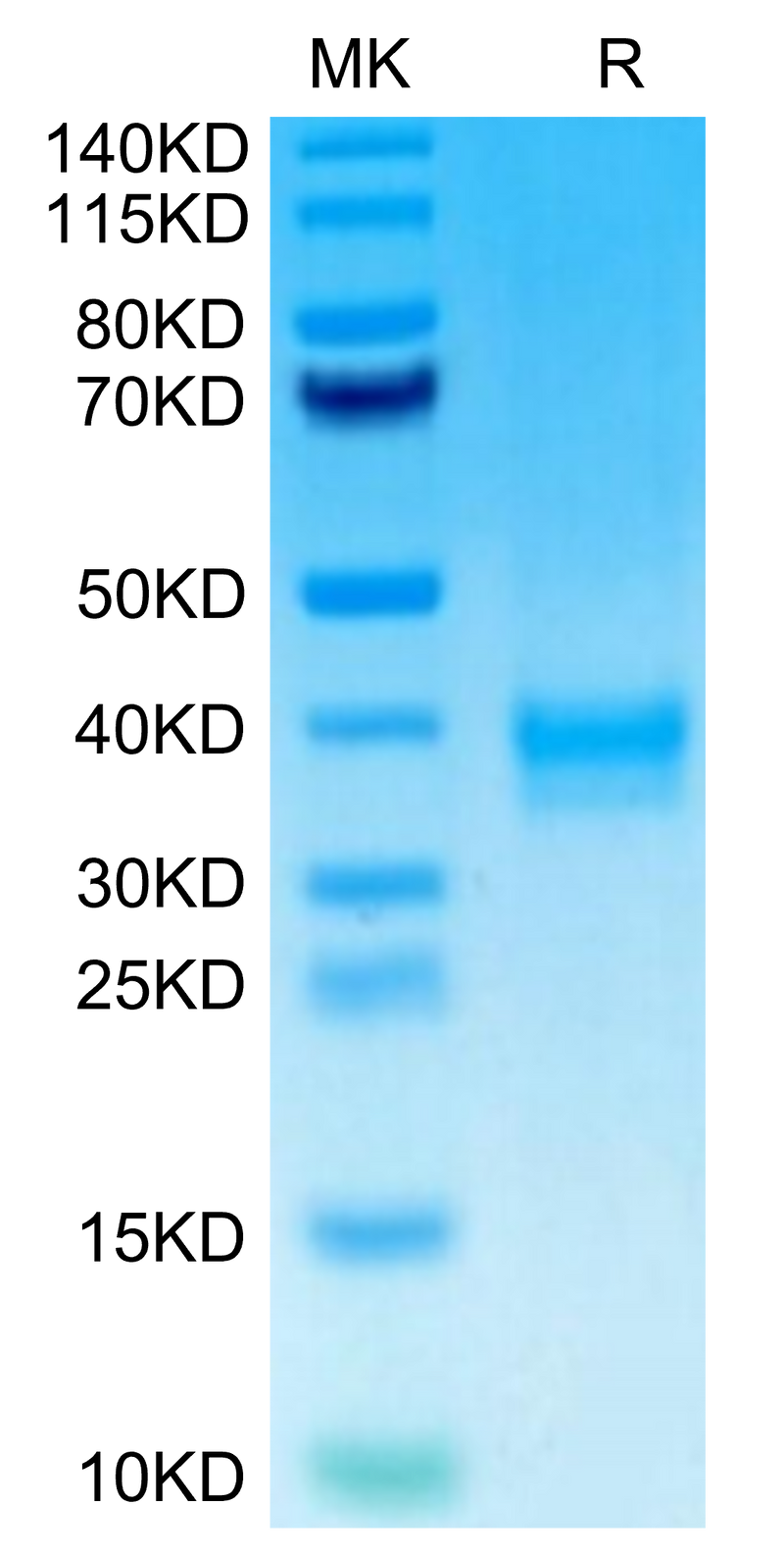 Human ANTXR2 on Tris-Bis PAGE under reduced condition. The purity is greater than 95%.Recombinant Human ANTXR2 Protein