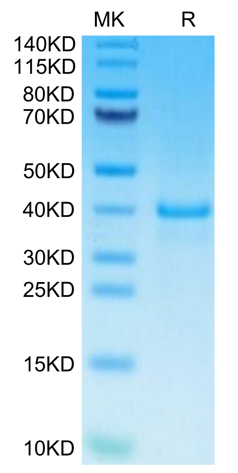 Human EGF on Tris-Bis PAGE under reduced condition. The purity is greater than 95%.Recombinant Human EGF Protein, Active