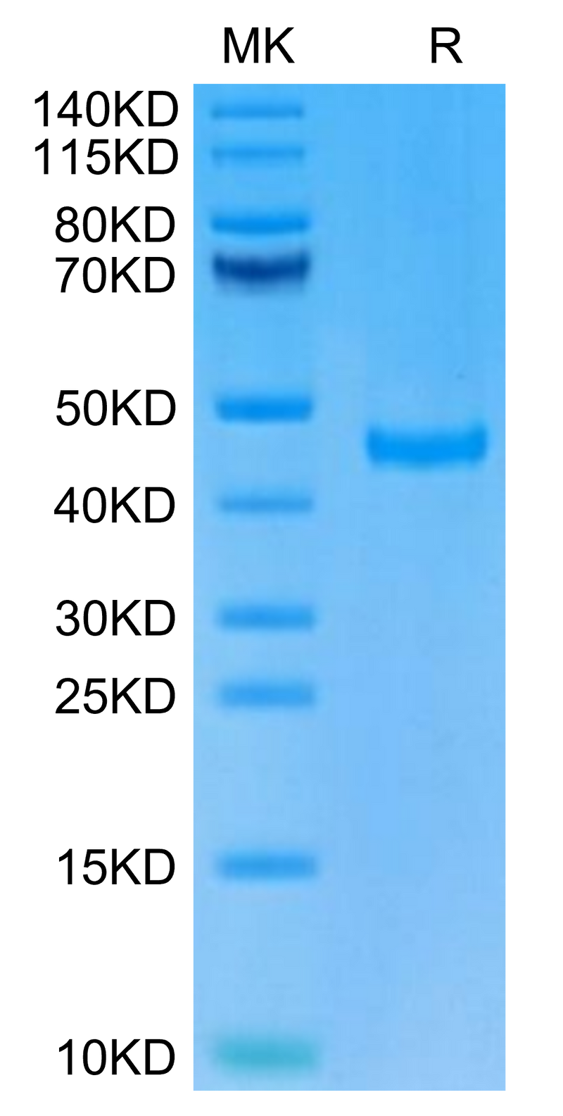 Cynomolgus SPARC on Tris-Bis PAGE under reduced condition. The purity is greater than 95%.Recombinant Cynomolgus SPARC Protein, Active