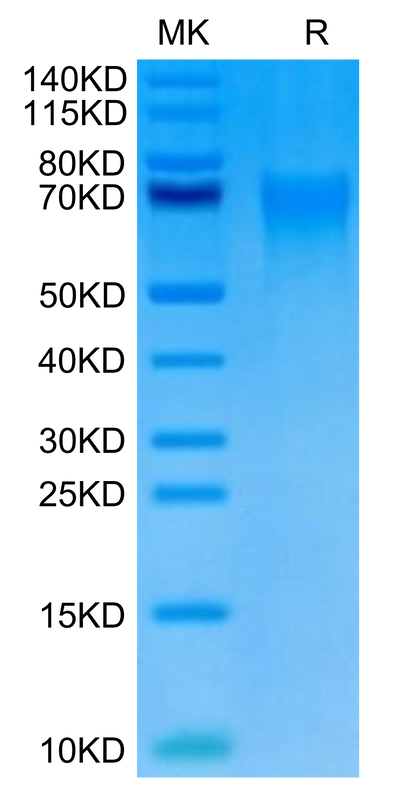 Cynomolgus DR6 on Tris-Bis PAGE under reduced condition. The purity is greater than 95%.Recombinant Cynomolgus DR6/TNFRSF21 Protein, Active