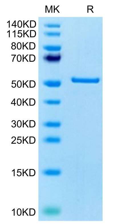 Human FNDC1 on Tris-Bis PAGE under reduced condition. The purity is greater than 95%.Recombinant Human FNDC1 Protein