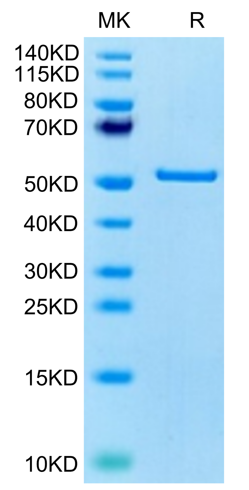 Human FNDC1 on Tris-Bis PAGE under reduced condition. The purity is greater than 95%.Recombinant Human FNDC1 Protein