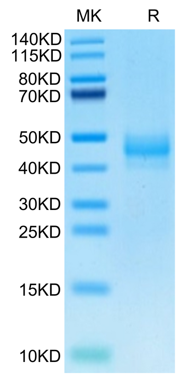 Rhesus macaque CTGF on Tris-Bis PAGE under reduced condition. The purity is greater than 95%.Recombinant Rhesus macaque CTGF/CCN2 Protein, Active
