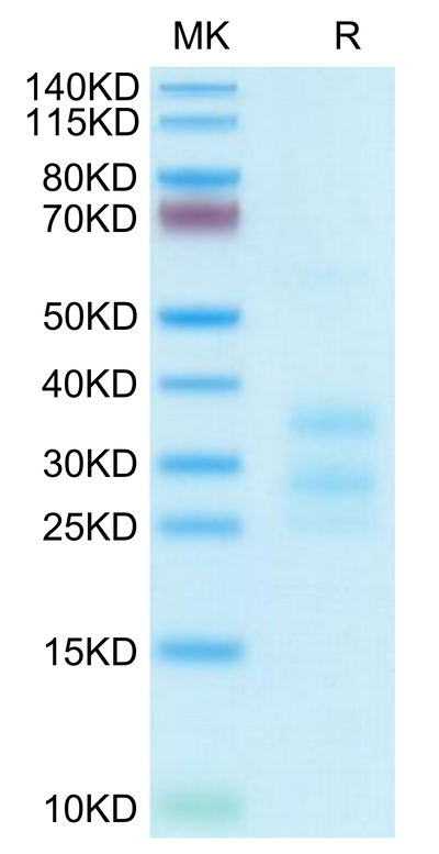 Human CD3E&CD3G on Tris-Bis PAGE under reduced condition. The purity is greater than 95%.Recombinant Human CD3E&CD3G/CD3 epsilon&CD3 gamma Protein, Active