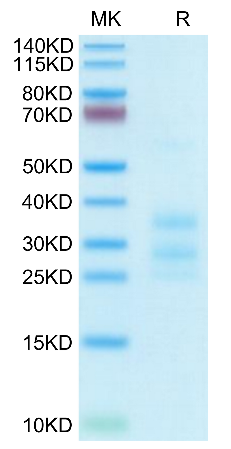 Human CD3E&CD3G on Tris-Bis PAGE under reduced condition. The purity is greater than 95%.Recombinant Human CD3E&CD3G/CD3 epsilon&CD3 gamma Protein, Active
