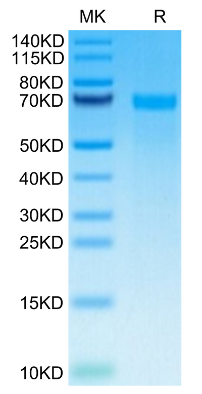 Human Tenascin on Tris-Bis PAGE under reduced condition. The purity is greater than 95%.Recombinant Human Tenascin Protein