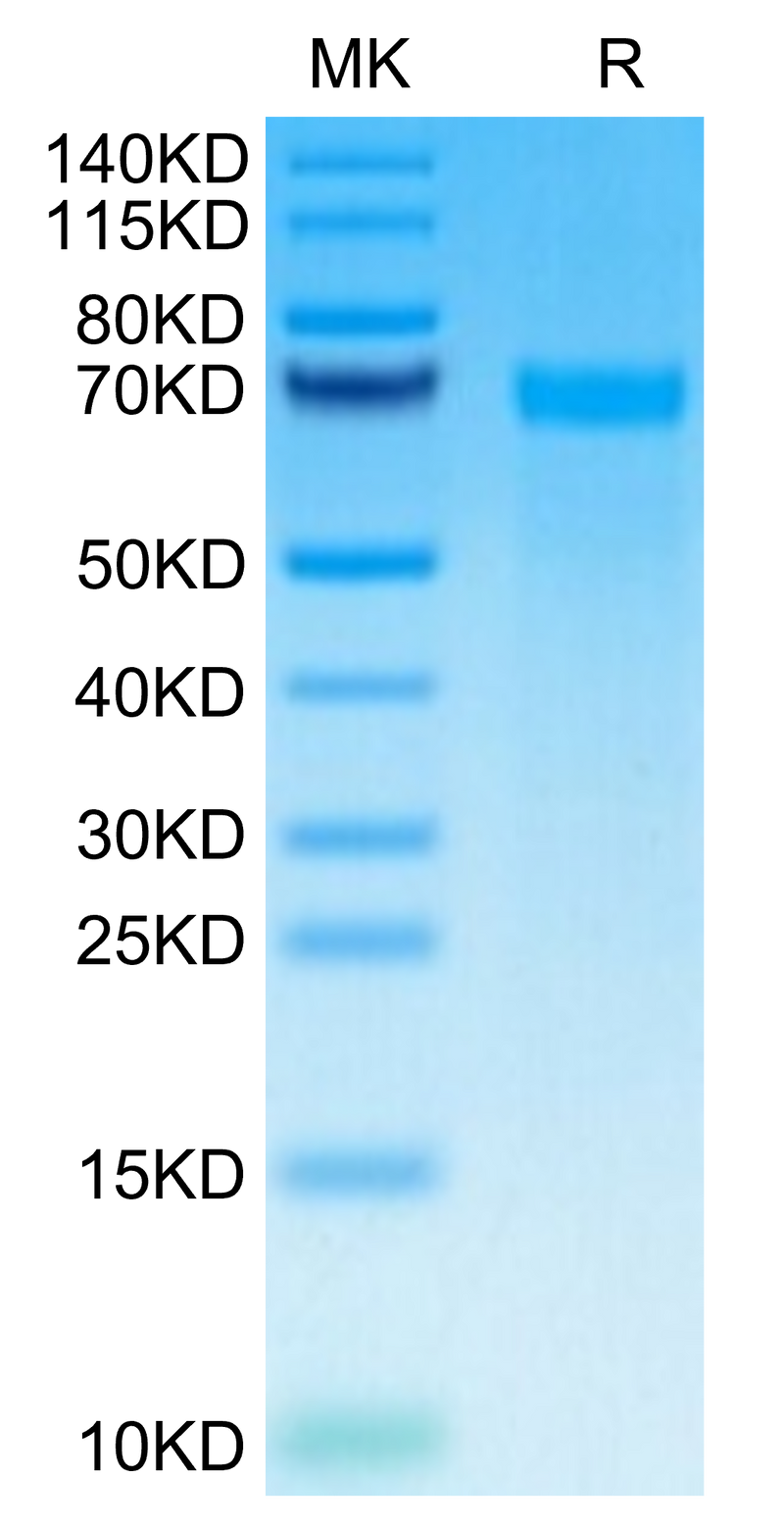 Human Tenascin on Tris-Bis PAGE under reduced condition. The purity is greater than 95%.Recombinant Human Tenascin Protein