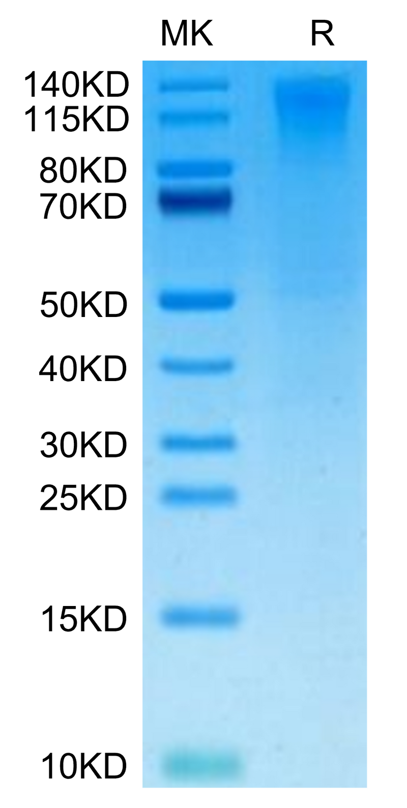 Biotinylated Human CD96 on Tris-Bis PAGE under reduced condition. The purity is greater than 95%.Biotinylated Human CD96/TACTILE Protein, Active