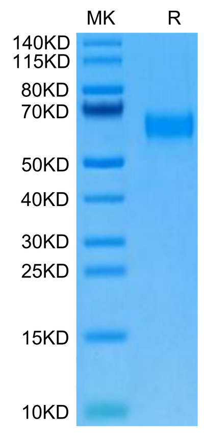 Cynomolgus AMIGO2 on Tris-Bis PAGE under reduced condition. The purity is greater than 95%.Recombinant Cynomolgus AMIGO2 Protein