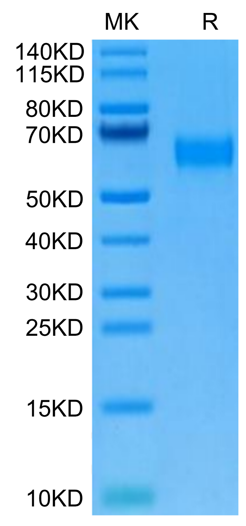 Cynomolgus AMIGO2 on Tris-Bis PAGE under reduced condition. The purity is greater than 95%.Recombinant Cynomolgus AMIGO2 Protein