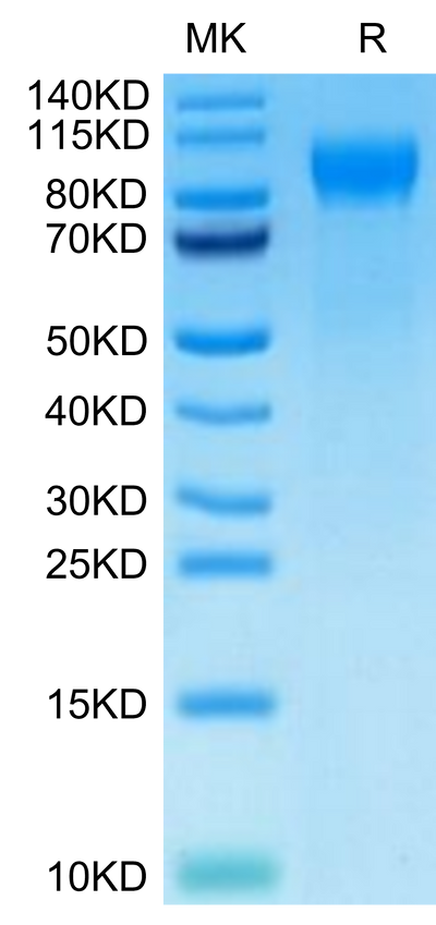 Cynomolgus E-selectin on Tris-Bis PAGE under reduced condition. The purity is greater than 95%.Recombinant Cynomolgus E-selectin/CD62E Protein, Active