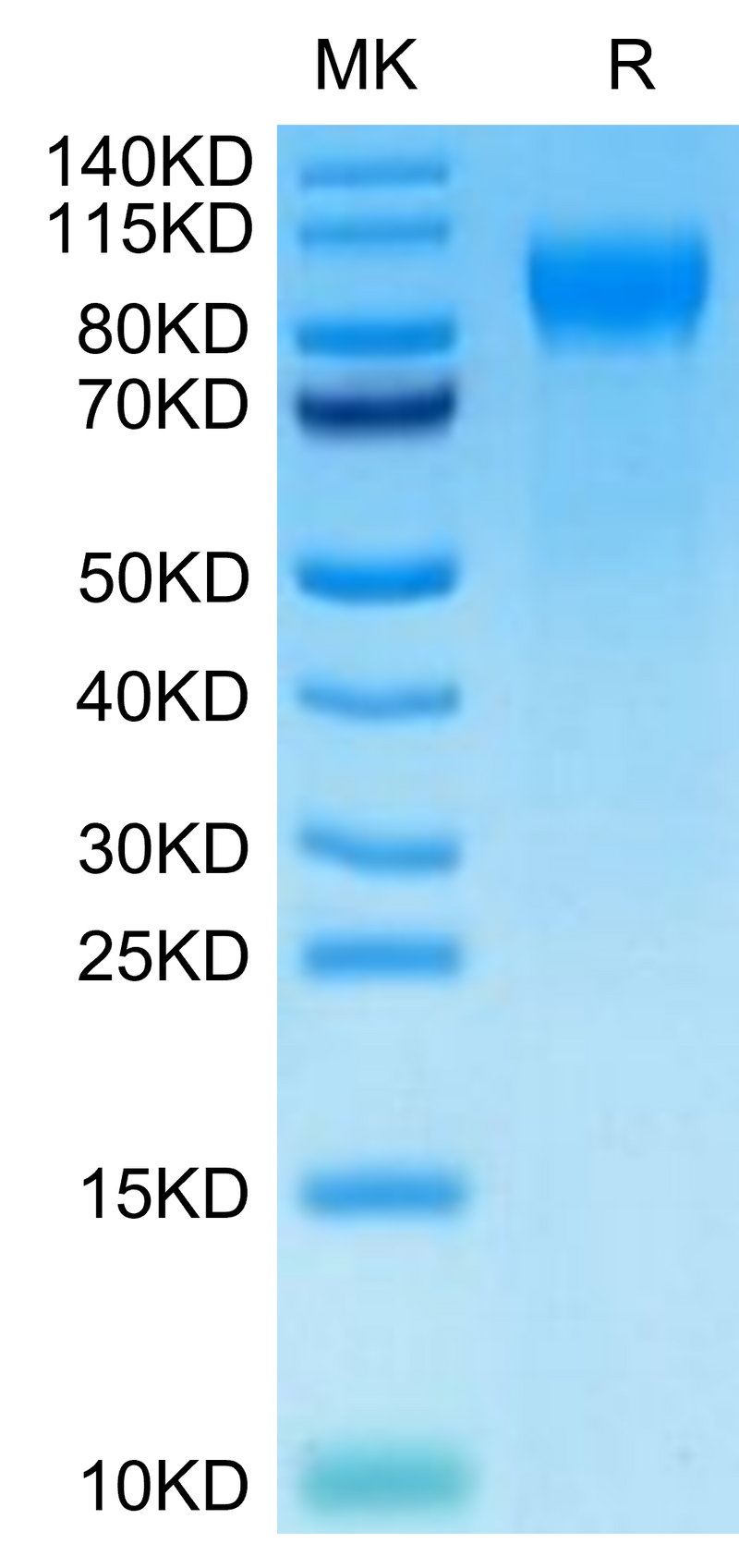 Cynomolgus E-selectin on Tris-Bis PAGE under reduced condition. The purity is greater than 95%.Recombinant Cynomolgus E-selectin/CD62E Protein, Active
