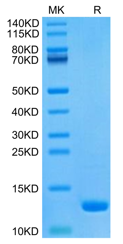 Human CCL8 on Tris-Bis PAGE under reduced condition. The purity is greater than 95%.Recombinant Human CCL8 Protein