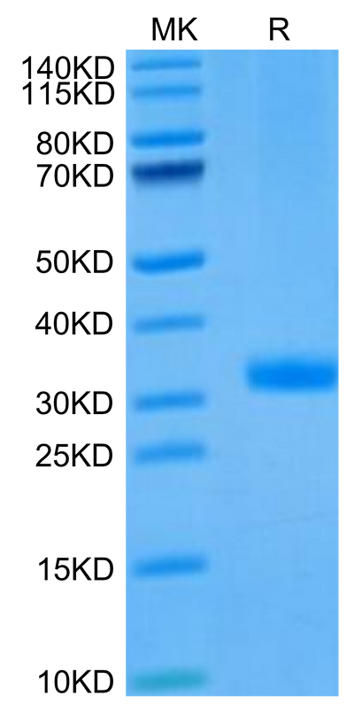 Mouse ANGPT2 on Tris-Bis PAGE under reduced condition. The purity is greater than 95%.Recombinant Mouse ANGPT2/Angiopoietin-2 Protein