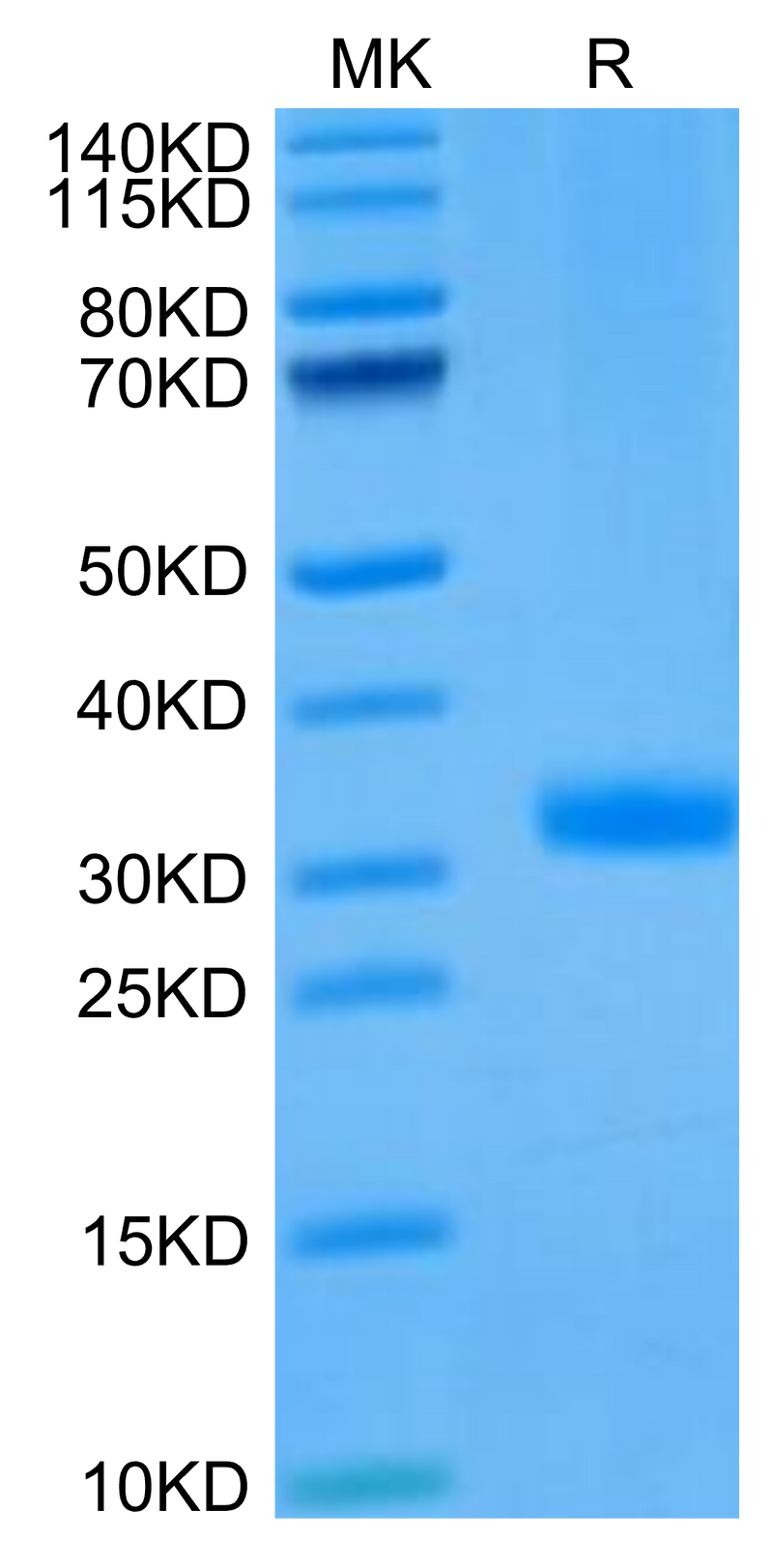 Mouse ANGPT2 on Tris-Bis PAGE under reduced condition. The purity is greater than 95%.Recombinant Mouse ANGPT2/Angiopoietin-2 Protein