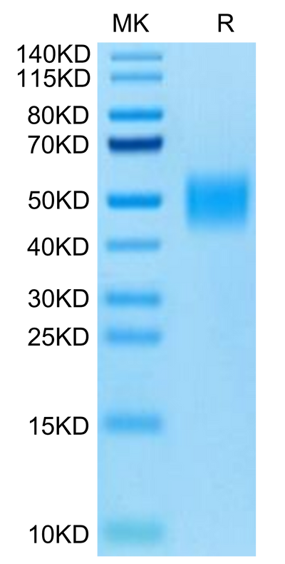 Cynomolgus IL-4 R alpha on Tris-Bis PAGE under reduced condition. The purity is greater than 95%.Recombinant Cynomolgus IL-4 R alpha/CD124 Protein, Active