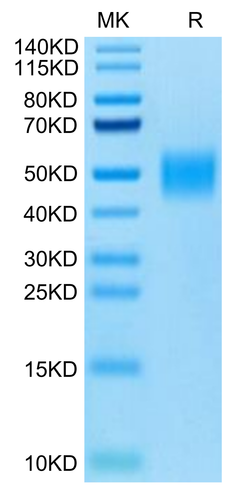 Cynomolgus IL-4 R alpha on Tris-Bis PAGE under reduced condition. The purity is greater than 95%.Recombinant Cynomolgus IL-4 R alpha/CD124 Protein, Active