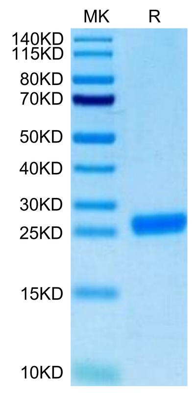 Cynomolgus NGAL on Tris-Bis PAGE under reduced condition. The purity is greater than 95%.Recombinant Cynomolgus NGAL/Lipocalin-2 Protein, Active