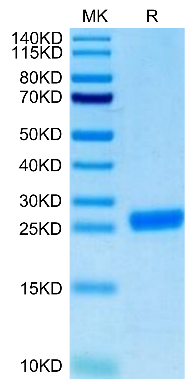 Cynomolgus NGAL on Tris-Bis PAGE under reduced condition. The purity is greater than 95%.Recombinant Cynomolgus NGAL/Lipocalin-2 Protein, Active