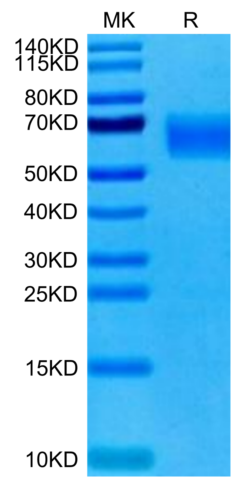 Cynomolgus TYRO3 on Tris-Bis PAGE under reduced condition. The purity is greater than 95%.Recombinant Cynomolgus TYRO3 Protein