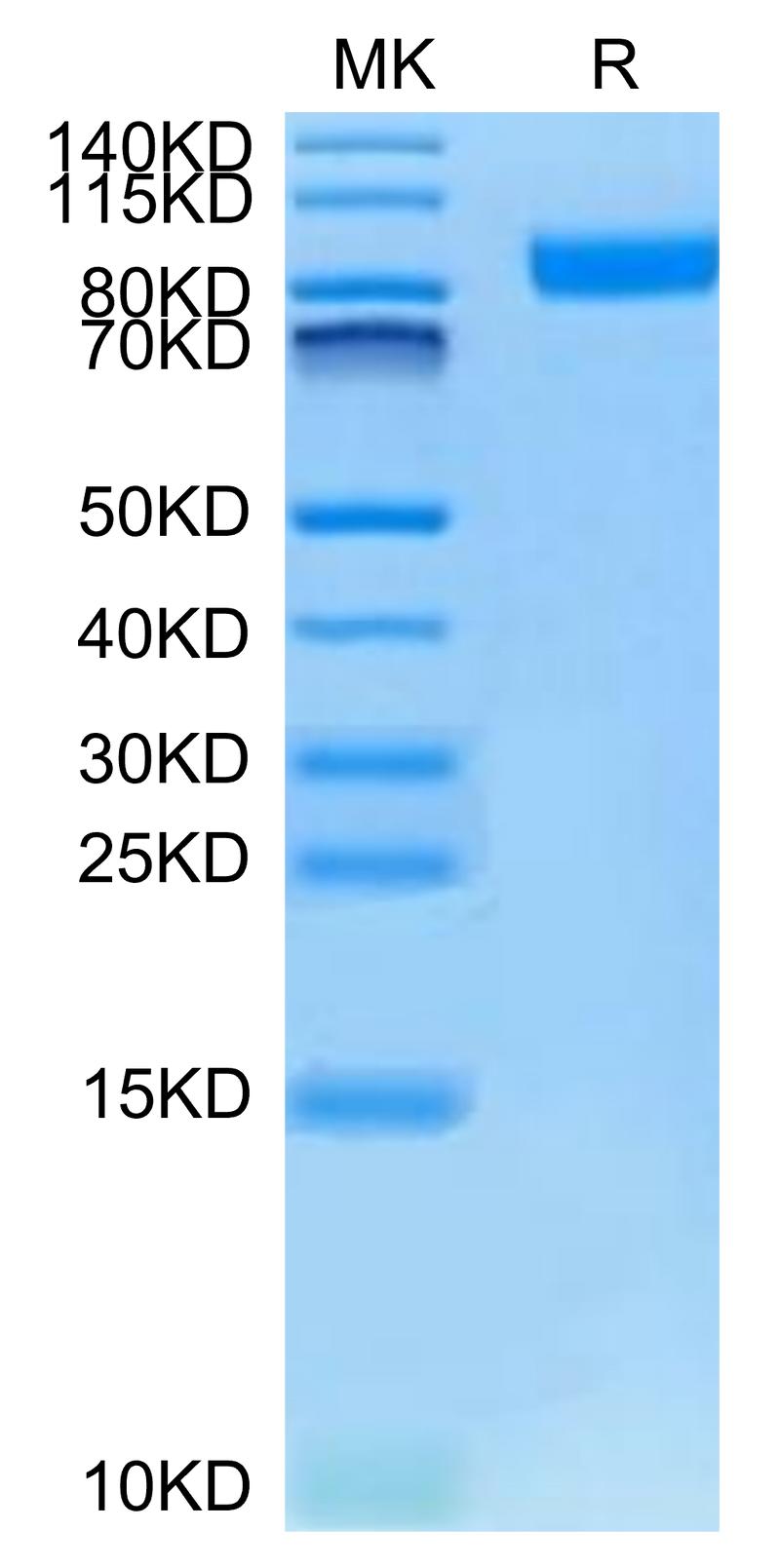 Cynomolgus Neuropilin-1 on Tris-Bis PAGE under reduced condition. The purity is greater than 95%.Recombinant Cynomolgus Neuropilin-1 Protein