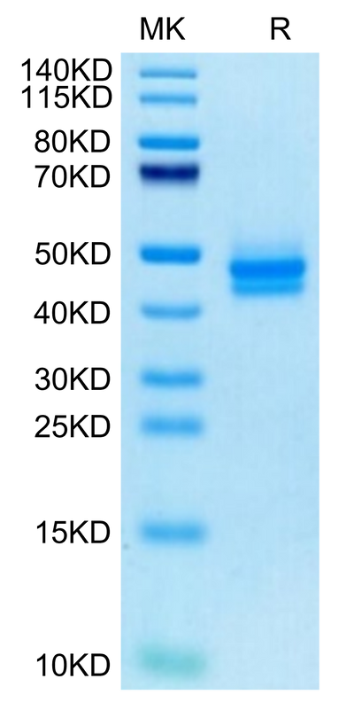 Cynomolgus IL-12B on Tris-Bis PAGE under reduced condition. The purity is greater than 95%.Recombinant Cynomolgus IL-12B/p40/NKSF2 Protein, Active