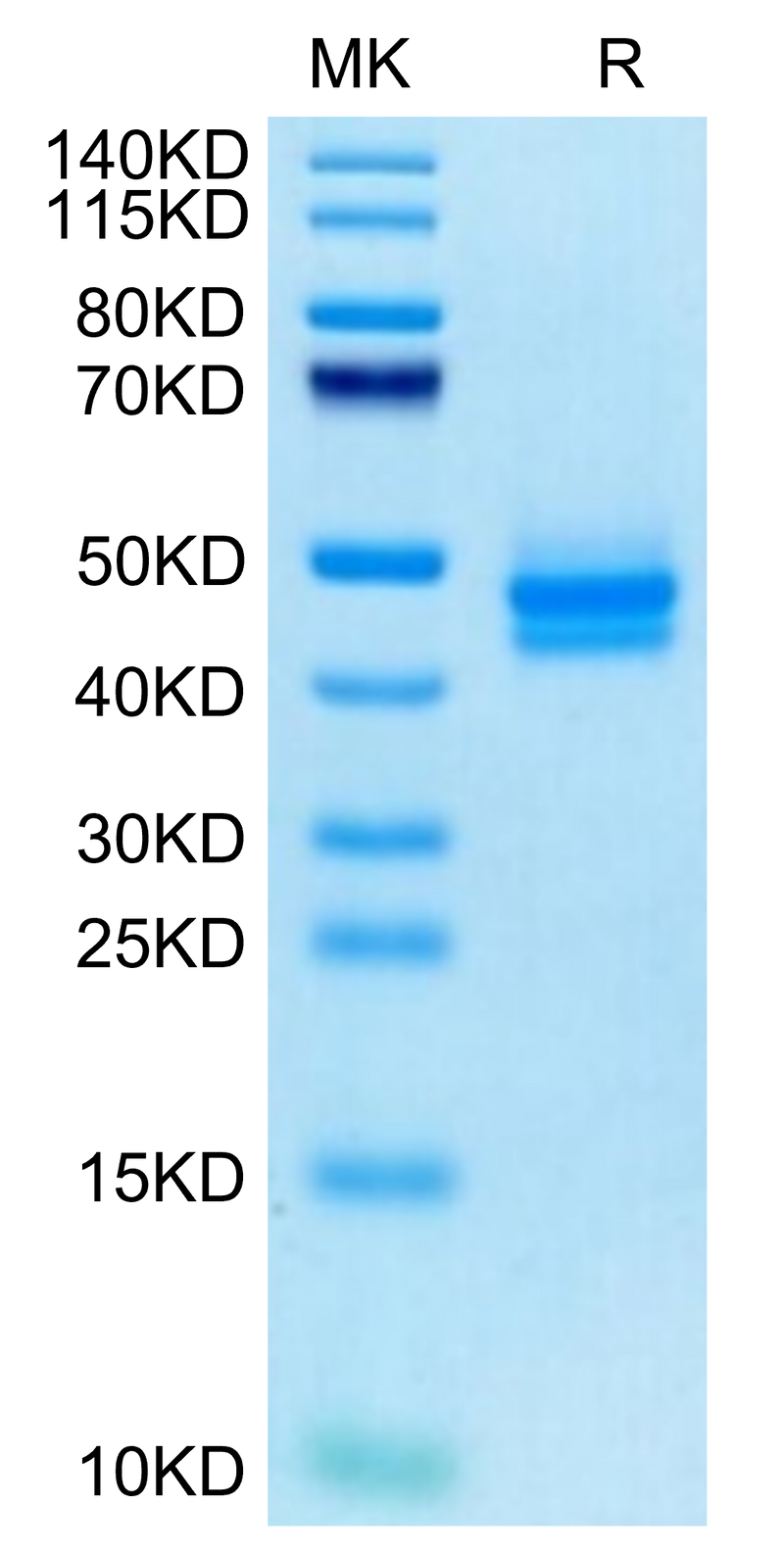 Cynomolgus IL-12B on Tris-Bis PAGE under reduced condition. The purity is greater than 95%.Recombinant Cynomolgus IL-12B/p40/NKSF2 Protein, Active