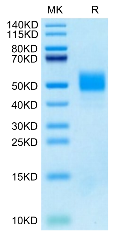 Cynomolgus MICA on Tris-Bis PAGE under reduced condition. The purity is greater than 95%.Recombinant Cynomolgus MICA Protein, Active