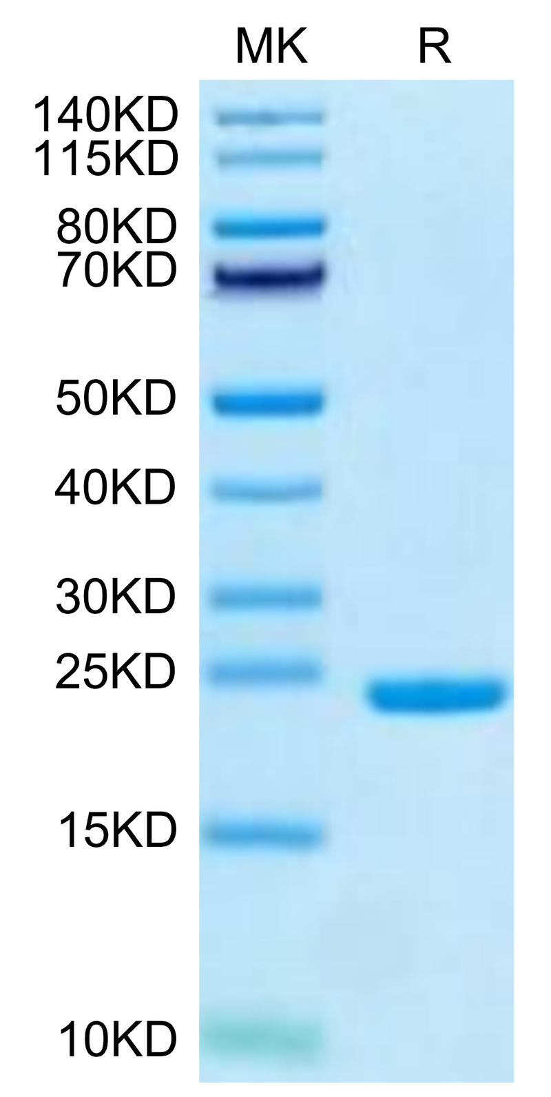 Canine keratin, type I cytoskeletal 19 (310-399) on Tris-Bis PAGE under reduced condition. The purity is greater than 95%.Recombinant Canine keratin, type I cytoskeletal 19 (310-399) Protein