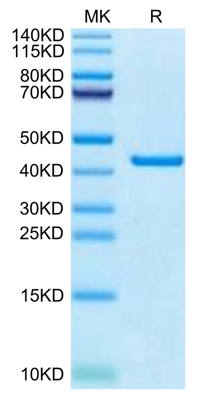 Canine PKA on Tris-Bis PAGE under reduced condition. The purity is greater than 95%.Recombinant Canine PKA/PRKACA Protein