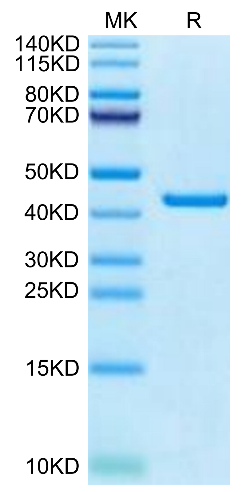 Canine PKA on Tris-Bis PAGE under reduced condition. The purity is greater than 95%.Recombinant Canine PKA/PRKACA Protein