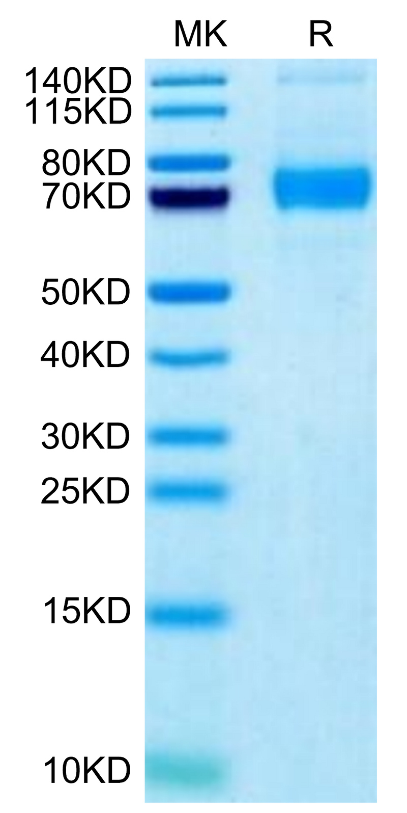 Biotinylated Human Siglec-5 on Tris-Bis PAGE under reduced condition. The purity is greater than 95%.Biotinylated Human Siglec-5/CD170 Protein