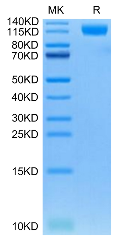 Cynomolgus OSMR on Tris-Bis PAGE under reduced condition. The purity is greater than 95%.Recombinant Cynomolgus OSMR Protein, Active
