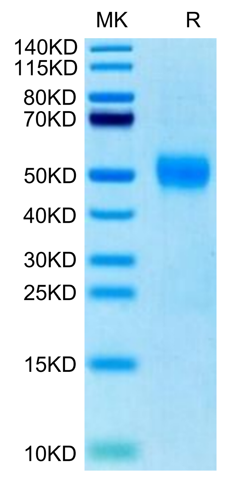 Biotinylated Human Siglec-3 on Tris-Bis PAGE under reduced condition. The purity is greater than 95%.Biotinylated Human Siglec-3/CD33 Protein, Active