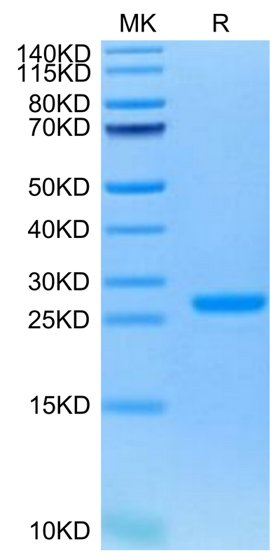 Human NGAL on Tris-Bis PAGE under reduced condition. The purity is greater than 95%.Recombinant Human NGAL/Lipocalin-2 Protein, Active