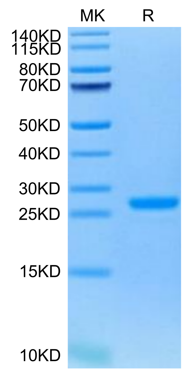 Human NGAL on Tris-Bis PAGE under reduced condition. The purity is greater than 95%.Recombinant Human NGAL/Lipocalin-2 Protein, Active