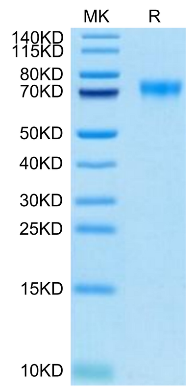 Biotinylated Human Siglec-9 on Tris-Bis PAGE under reduced condition. The purity is greater than 95%.Biotinylated Human Siglec-9 Protein