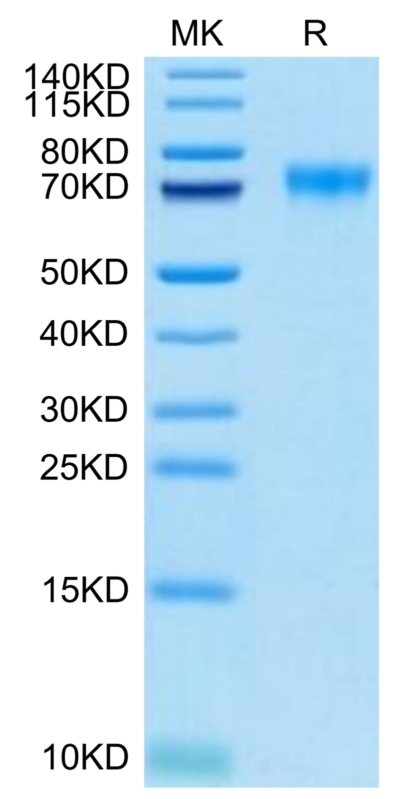 Biotinylated Human Siglec-9 on Tris-Bis PAGE under reduced condition. The purity is greater than 95%.Biotinylated Human Siglec-9 Protein