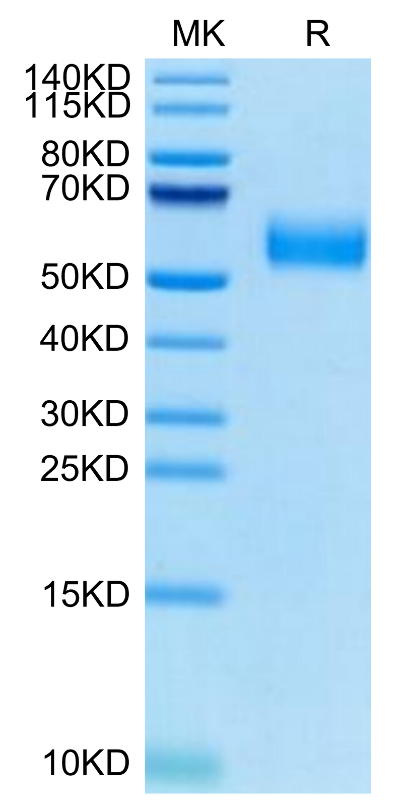 Biotinylated Human SIRP alpha V8 on Tris-Bis PAGE under reduced condition. The purity is greater than 95%.Biotinylated Human SIRP alpha V8 Protein, Active
