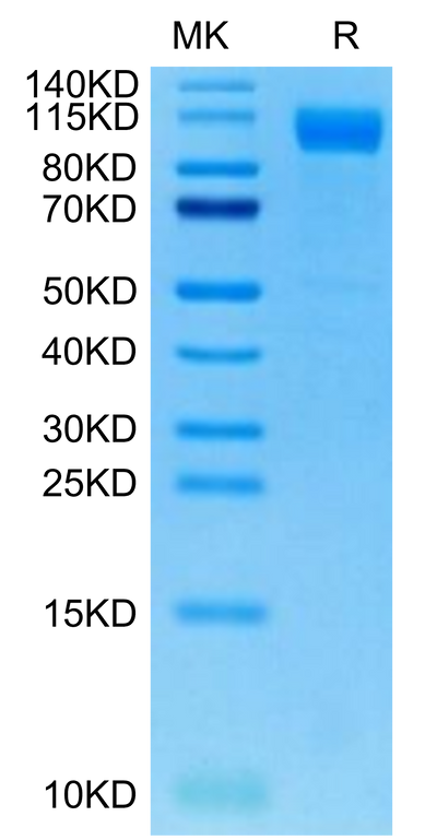 SARS-COV-2 Spike S1 (Deltacron) on Tris-Bis PAGE under reduced condition. The purity is greater than 95%.Recombinant SARS-COV-2 Spike S1 (Deltacron) Protein, Active