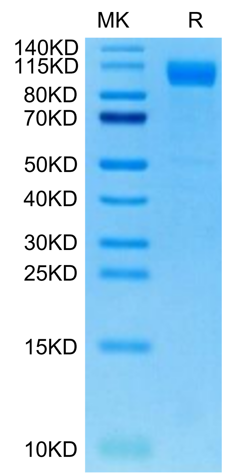 SARS-COV-2 Spike S1 (Deltacron) on Tris-Bis PAGE under reduced condition. The purity is greater than 95%.Recombinant SARS-COV-2 Spike S1 (Deltacron) Protein, Active