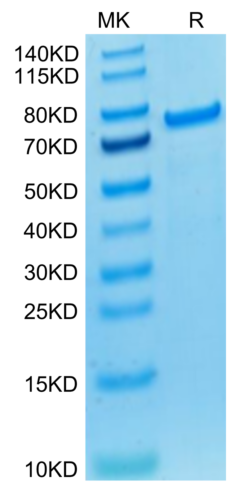 Biotinylated Cynomolgus PADI4 (Primary Amine Labeling) on Tris-Bis PAGE under reduced condition. The purity is greater than 95%.Biotinylated Cynomolgus PADI4 Protein (Primary Amine Labeling)