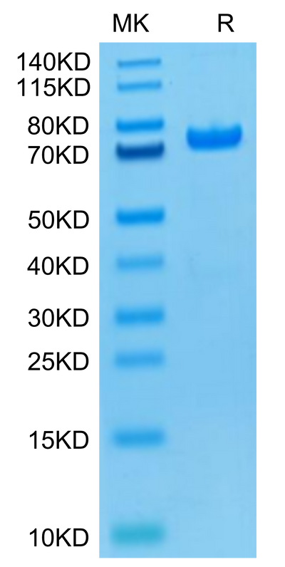 Biotinylated Human PADI4 (Primary Amine Labeling) on Tris-Bis PAGE under reduced condition. The purity is greater than 95%.Biotinylated Human PADI4 Protein (Primary Amine Labeling)