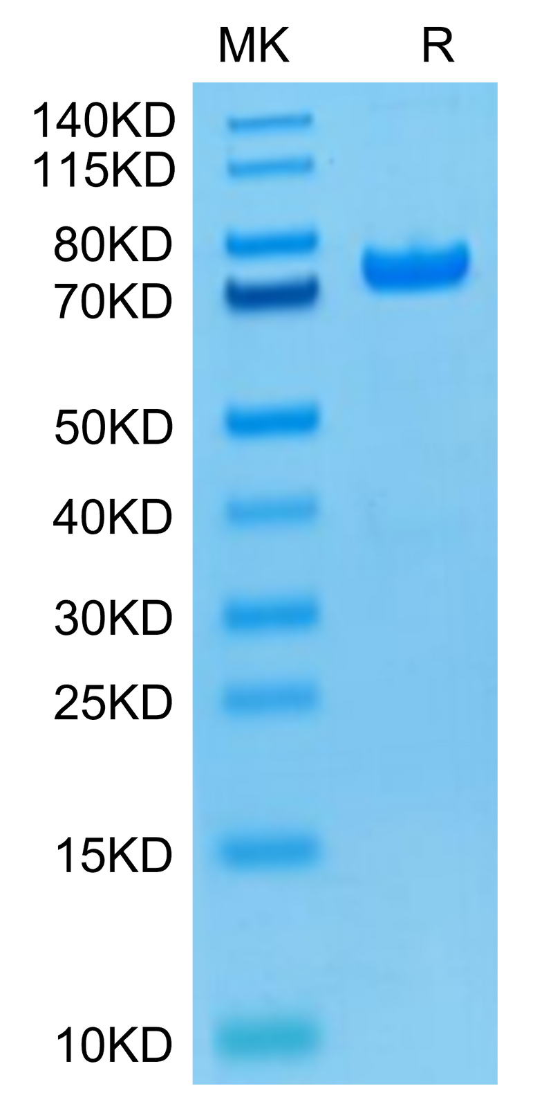 Biotinylated Human PADI4 (Primary Amine Labeling) on Tris-Bis PAGE under reduced condition. The purity is greater than 95%.Biotinylated Human PADI4 Protein (Primary Amine Labeling)