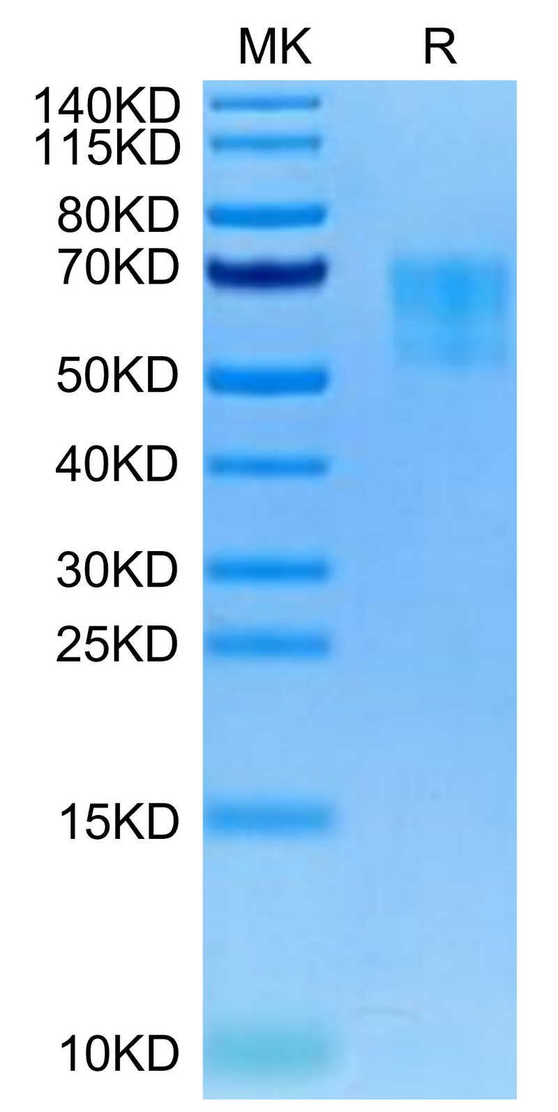 Biotinylated Human TPBG on Tris-Bis PAGE under reduced condition. The purity is greater than 95%.Biotinylated Human TPBG/5T4 Protein, Active