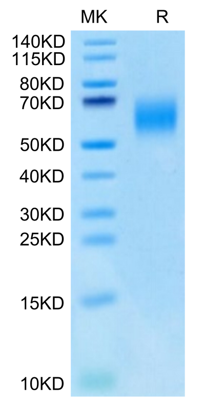 Cynomolgus IL-13Ra1 on Tris-Bis PAGE under reduced condition. The purity is greater than 95%.Recombinant Cynomolgus IL-13Ra1 Protein, Active