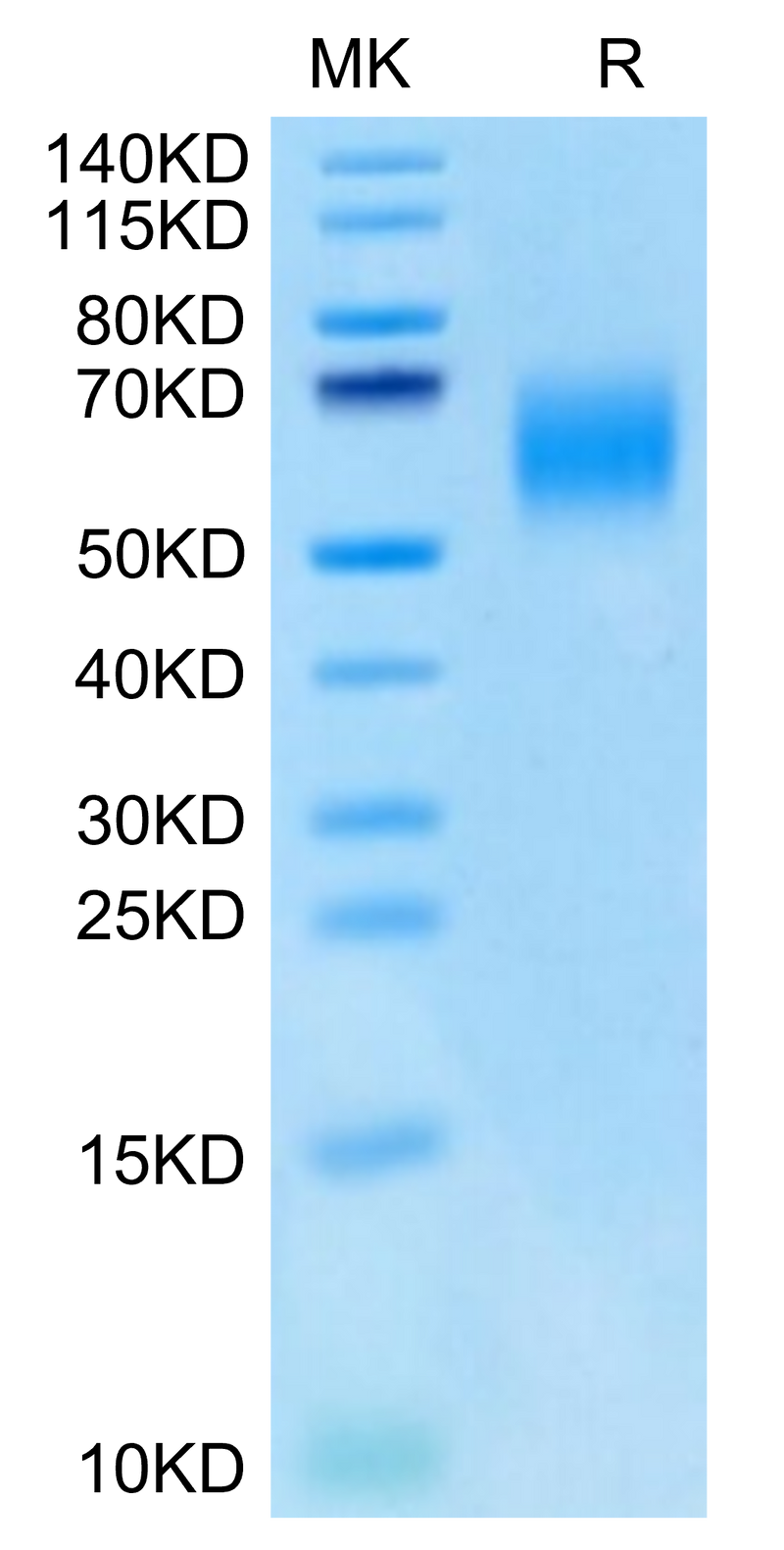 Cynomolgus IL-13Ra1 on Tris-Bis PAGE under reduced condition. The purity is greater than 95%.Recombinant Cynomolgus IL-13Ra1 Protein, Active
