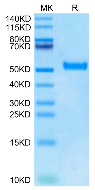 Biotinylated Human DKK1 N terminal Domain on Tris-Bis PAGE under reduced condition. The purity is greater than 95%.Biotinylated Human DKK1 N terminal Domain Protein