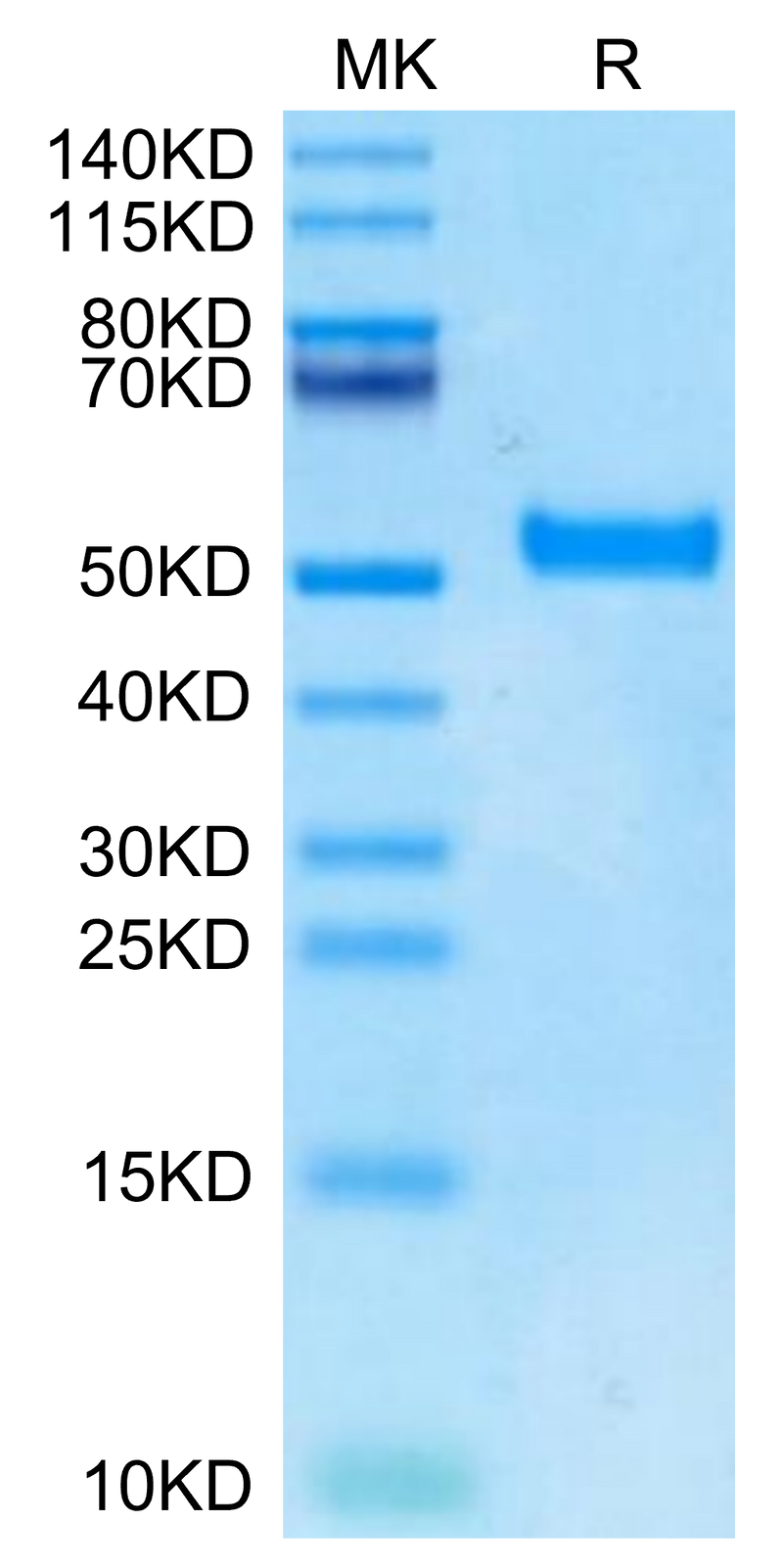 Biotinylated Human DKK1 N terminal Domain on Tris-Bis PAGE under reduced condition. The purity is greater than 95%.Biotinylated Human DKK1 N terminal Domain Protein