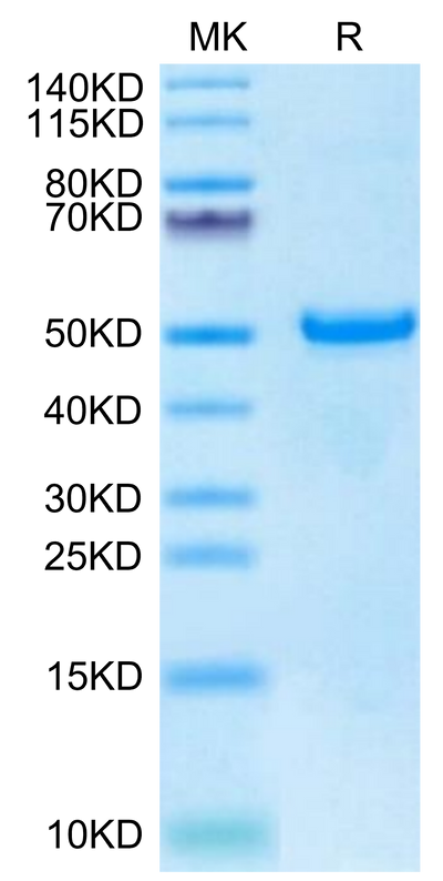 Biotinylated Human DKK1 C terminal Domain on Tris-Bis PAGE under reduced condition. The purity is greater than 95%.Biotinylated Human DKK1 C terminal Domain Protein, Active